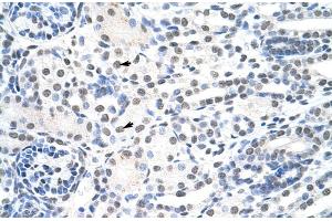 Immunohistochemistry (IHC) image for anti-THO Complex 1 (THOC1) (C-Term) antibody (ABIN2778931)