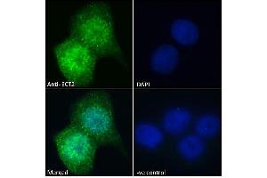 (ABIN185018) Immunofluorescence analysis of paraformaldehyde fixed A431 cells, permeabilized with 0. (ECT2 Antikörper  (N-Term))