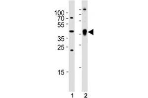 Western blot analysis of (1) zebrafish brain and (2) whole zebrafish tissue lysate using Ada antibody.