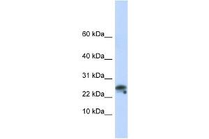 Granulysin antibody used at 1 ug/ml to detect target protein. (GNLY Antikörper  (N-Term))