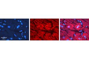 Rabbit Anti-NXF1 Antibody   Formalin Fixed Paraffin Embedded Tissue: Human heart Tissue Observed Staining: Cytoplasmic, nucleus Primary Antibody Concentration: N/A Other Working Concentrations: 1:600 Secondary Antibody: Donkey anti-Rabbit-Cy3 Secondary Antibody Concentration: 1:200 Magnification: 20X Exposure Time: 0. (NXF1 Antikörper  (N-Term))