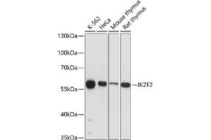 Western blot analysis of extracts of various cell lines, using IKZF2 antibody (ABIN6130817, ABIN6142288, ABIN6142289 and ABIN6215874) at 1:3000 dilution.