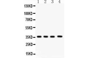 Western Blotting (WB) image for anti-PDZ Binding Kinase (PBK) (AA 71-322) antibody (ABIN3043592)