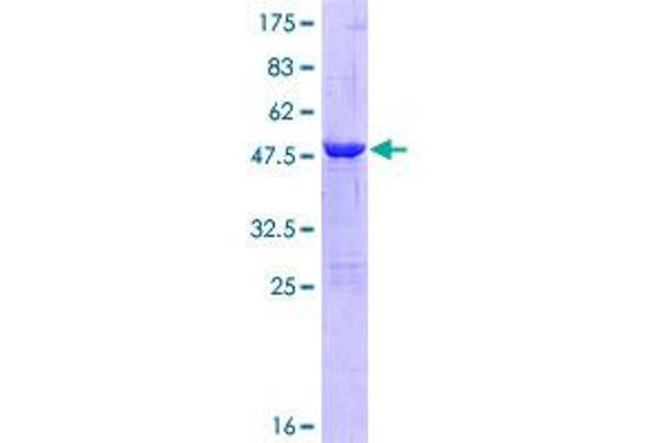 ABHD14B Protein (AA 1-210) (GST tag)