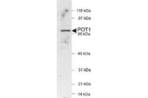 Western blot analysis of POT1 in HeLa nuclear extracts (25 ug) with POT1 polyclonal antibody . (POT1 Antikörper  (AA 200-300))