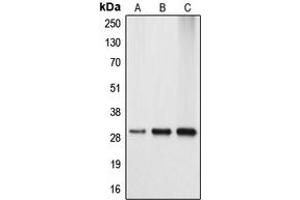 Western blot analysis of APOA1BP expression in HEK293T (A), mouse kidney (B), rat kidney (C) whole cell lysates. (APOA1BP Antikörper  (Center))