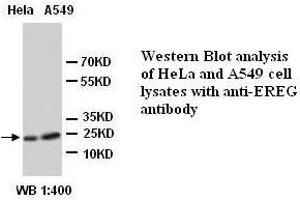 Image no. 1 for anti-Epiregulin (EREG) (Internal Region) antibody (ABIN790928) (Epiregulin Antikörper  (Internal Region))