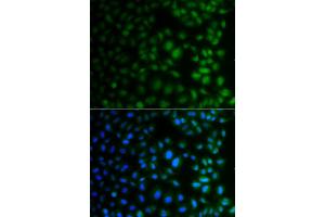 Immunofluorescence analysis of A549 cells using NAA40 antibody (ABIN4904481).