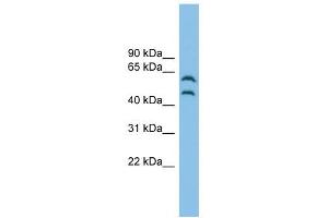 CSK antibody used at 1 ug/ml to detect target protein. (CSK Antikörper  (Middle Region))