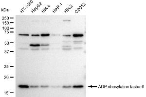 Western blotting analysis using ADP ribosylation factor 6 antibody (ABIN7797532).