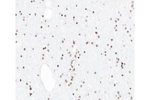 ABIN6266861 at 1/100 staining human brain tissue sections by IHC-P. (PIAS1 Antikörper  (N-Term))