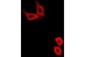 Immunofluorescent analysis of Hexokinase 2 staining in U2OS cells. (Hexokinase 2 Antikörper)