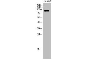 Western Blot analysis of HepG2 cells using Acetyl-PCAF (K428) Polyclonal Antibody (KAT2B Antikörper  (acLys428))