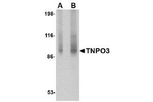 Image no. 1 for anti-Transportin 3 (TNPO3) (N-Term) antibody (ABIN1494360)