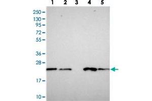 Western blot analysis of Lane 1: RT-4, Lane 2: U-251 MG, Lane 3: Human Plasma, Lane 4: Liver, Lane 5: Tonsil with COMMD2 polyclonal antibody  at 1:250-1:500 dilution. (COMMD2 Antikörper)
