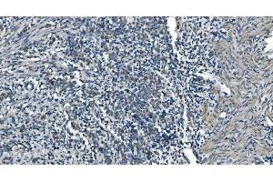 IHC analysis of TIMM8A/DDP using anti-TIMM8A/DDP antibody (ABIN7600039). (TIMM8A/DDP Antikörper  (AA 14-97))