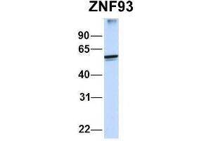 Host:  Rabbit  Target Name:  ZNF93  Sample Type:  Human MCF7  Antibody Dilution:  1. (ZNF93 Antikörper  (N-Term))