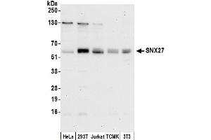 anti-Sorting Nexin 27 (SNX27) (AA 125-175) antibody