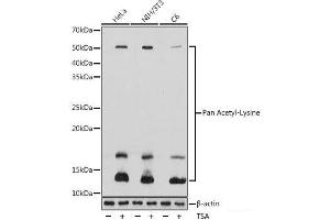 Western blot analysis of extracts of various cell lines using Pan Acetyl-Lysine Polyclonal Antibody at dilution of 1:1000. (Acetylated Lysine Antikörper)