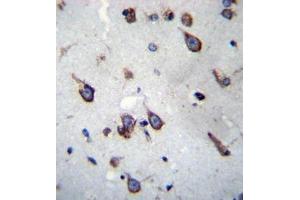 Formalin fixed, paraffin embedded human brain tissue stained with SIM1 Antibody (N-term) followed by peroxidase conjugation of the secondary antibody and DAB staining.