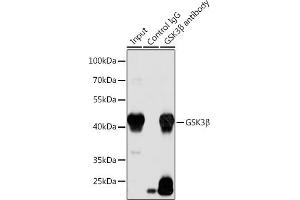 Immunoprecipitation analysis of 200 μg extracts of LO2 cells using 3 μg GSK3β antibody . (GSK3 beta Antikörper)