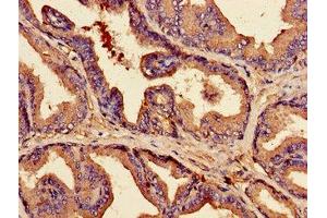 Immunohistochemistry of paraffin-embedded human prostate tissue using ABIN7147903 at dilution of 1:100 (Claudin 3 Antikörper  (AA 181-220))