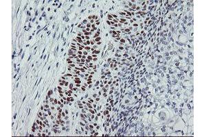 Image no. 1 for anti-Tumor Protein P53 (TP53) antibody (ABIN1499967) (p53 Antikörper)