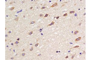 Formalin-fixed and paraffin embedded rat brain labeled with Rabbit Anti-SSTR3 Polyclonal Antibody, Unconjugated  at 1:200 followed by conjugation to the secondary antibody and DAB staining (SSTR3 Antikörper)