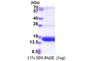 SDS-PAGE (SDS) image for WW and C2 Domain Containing 1 (WWC1) (AA 655-783) protein (His tag) (ABIN5853532) (WWC1 Protein (AA 655-783) (His tag))