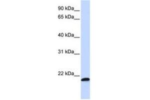 Image no. 1 for anti-Chromosome 21 Open Reading Frame 56 (C21orf56) (AA 108-157) antibody (ABIN6740942) (C21ORF56 Antikörper  (AA 108-157))