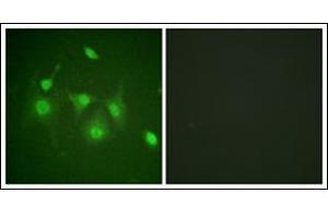 Immunofluorescence analysis of HepG2 cells, using HDAC6 Antibody. (HDAC6 Antikörper  (N-Term))