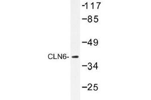Image no. 1 for anti-Ceroid-Lipofuscinosis, Neuronal 6, Late Infantile, Variant (CLN6) antibody (ABIN317825) (CLN6 Antikörper)