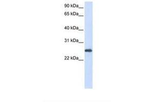 Image no. 1 for anti-Peroxiredoxin 1 (PRDX1) (N-Term) antibody (ABIN6738463) (Peroxiredoxin 1 Antikörper  (N-Term))