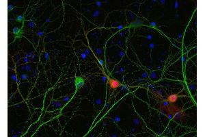 Indirect immunostaining of PFA fixed rat hippocampus neurons with anti-calbindin (dilution 1 : 5000; red) and mouse anti-MAP 2 (, dilution 1 : 1000; green). (CALB1 Antikörper)