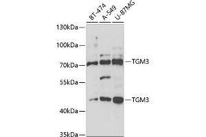 Western blot analysis of extracts of various cell lines, using TGM3 antibody (ABIN6132263, ABIN6149094, ABIN6149095 and ABIN6221560) at 1:1000 dilution. (TGM3 Antikörper  (AA 1-180))