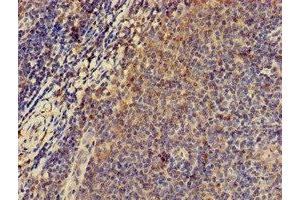 Immunohistochemistry of paraffin-embedded human lymph node tissue using ABIN7146620 at dilution of 1:100