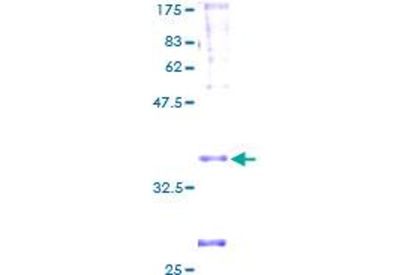 PEN2 Protein (AA 1-101) (GST tag)