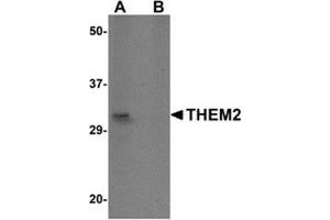 Western blot analysis of THEM2 in HepG2 cell lysate with this product at 1 μg/ml in (A) the absence and (B) the presence of blocking peptide. (THEM2 Antikörper  (C-Term))