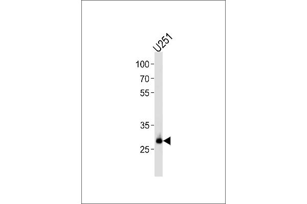 CNOT8 Antikörper  (C-Term)