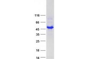Western Blotting (WB) image for Hydroxysteroid Dehydrogenase Like 2 (HSDL2) protein (Myc-DYKDDDDK Tag) (ABIN2723075)