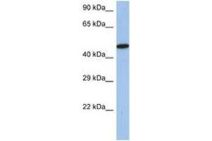 Image no. 1 for anti-Interferon Regulatory Factor 5 (IRF5) (AA 395-444) antibody (ABIN6742243) (IRF5 Antikörper  (AA 395-444))