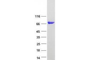 Western Blotting (WB) image for 3'-phosphoadenosine 5'-phosphosulfate Synthase 1 (PAPSS1) protein (Myc-DYKDDDDK Tag) (ABIN2728214)