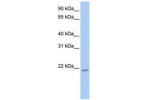 Image no. 1 for anti-Ring Finger Protein 5, E3 Ubiquitin Protein Ligase (RNF5) (N-Term) antibody (ABIN6741432) (RNF5 Antikörper  (N-Term))