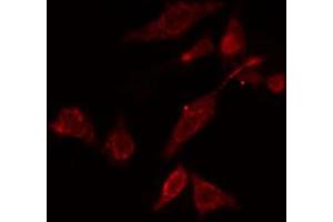 ABIN6274758 staining COLO cells by IF/ICC. (RPS5 Antikörper  (Internal Region))