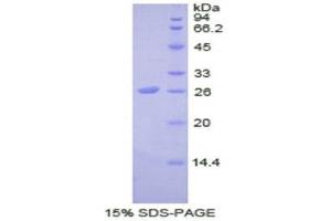 SDS-PAGE (SDS) image for Stromal Cell Derived Factor 4 (SDF4) (AA 154-362) protein (His tag) (ABIN2122142)