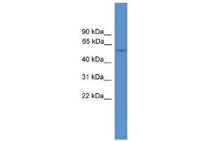 ALDH5A1 antibody used at 0. (ALDH5A1 Antikörper  (Middle Region))