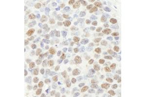 Immunohistochemistry (IHC) image for anti-Mismatch Repair Protein 2 (MSH2) (C-Term) antibody (ABIN7448673) (MSH2 Antikörper  (C-Term))