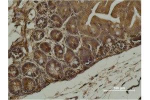 Immunohistochemistry (IHC) analysis of paraffin-embedded Mouse Cecal Tissue using alpha-SMA Monoclonal Antibody. (alpha-SMA Antikörper)