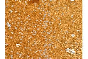 ABIN6261169 and ABIN6273038 at 1/100 staining Rat brain tissue by IHC-P.