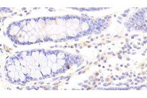 Immunohistochemistry (IHC) image for anti-Indoleamine 2,3-Dioxygenase (IDO) (AA 2-403) antibody (ABIN7433768)